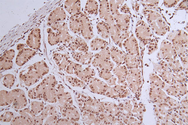 IHC image of CSB-RA072684A0HU diluted at 1:50 and staining in paraffin-embedded human stomach tissue performed on a Leica BondTM system. After dewaxing and hydration, antigen retrieval was mediated by high pressure in a citrate buffer (pH 6.0) . Section was blocked with 10% normal goat serum 30min at RT. Then primary antibody (1% BSA) was incubated at 4°C overnight. The primary is detected by a Goat anti-rabbit polymer IgG labeled by HRP and visualized using 0.32% DAB.