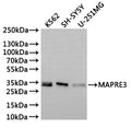 Western Blot
Positive WB detected in: K562 whole cell lysate(30µg), SH-SY5Y whole cell lysate(30µg), U-251MG whole cell lysate(30µg)
All lanes: MAPRE3 antibody at 1:1000
Secondary
Goat polyclonal to rabbit IgG at 1/40000 dilution
Predicted band size: 32 kDa
Observed band size: 32 kDa
Exposure time：2min