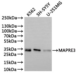 Western Blot
Positive WB detected in: K562 whole cell lysate(30µg), SH-SY5Y whole cell lysate(30µg), U-251MG whole cell lysate(30µg)
All lanes: MAPRE3 antibody at 1:1000
Secondary
Goat polyclonal to rabbit IgG at 1/40000 dilution
Predicted band size: 32 kDa
Observed band size: 32 kDa
Exposure time：2min