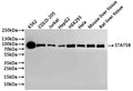 Western Blot
Positive WB detected in: K562 whole cell lysate(30µg), COLO-205 whole cell lysate(30µg), Jurkat whole cell lysate(30µg), HepG2 whole cell lysate(30µg), HEK293 whole cell lysate(30µg), Hela whole cell lysate(30µg), Mouse liver tissue lysate(30µg), Rat liver tissue lysate(30µg)
All lanes: STAT5B antibody at 1:1000
Secondary
Goat polyclonal to rabbit IgG at 1/40000 dilution
Predicted band size: 90 kDa
Observed band size: 100 kDa
Exposure time：3min