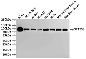 Western Blot
Positive WB detected in: K562 whole cell lysate(30µg), COLO-205 whole cell lysate(30µg), Jurkat whole cell lysate(30µg), HepG2 whole cell lysate(30µg), HEK293 whole cell lysate(30µg), Hela whole cell lysate(30µg), Mouse liver tissue lysate(30µg), Rat liver tissue lysate(30µg)
All lanes: STAT5B antibody at 1:1000
Secondary
Goat polyclonal to rabbit IgG at 1/40000 dilution
Predicted band size: 90 kDa
Observed band size: 100 kDa
Exposure time：3min