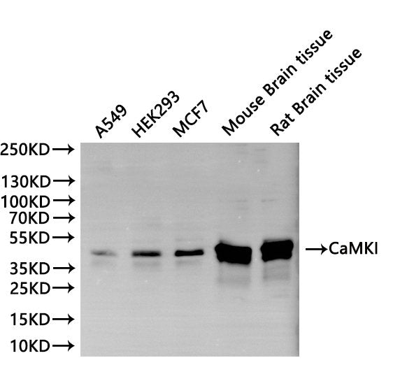 Western Blot, 
Positive WB detected in:A549 whole cell lysate(30µg), HEK293 whole cell lysate(30µg), MCF7 whole cell lysate(30µg), Mouse brain tissue lysate(30µg), Rat brain lysate(30µg)
All lanes: CaMKI antibody at 1:1000
Secondary
Goat polyclonal to rabbit IgG at 1/40000 dilution
Predicted band size: 41 kDa
Observed band size: 41 kDa
Exposure time：120s