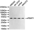 Western Blot
Positive WB detected in: HEK293 whole cell lysate(30µg) , SH-SY5Y whole cell lysate(30µg) , Jurkat whole cell lysate(30µg) , NIH/3T3 whole cell lysate(30µg) 
All lanes: PRMT1 antibody at 1:1000
Secondary
Goat polyclonal to rabbit IgG at 1/50000 dilution
Predicted band size: 42 kDa
Observed band size: 42 kDa
Exposure time: 2min