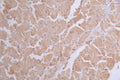 IHC image of CSB-RA076873A0HU diluted at 1:50 and staining in paraffin-embedded human heart tissue performed on a Leica BondTM system. After dewaxing and hydration, antigen retrieval was mediated by high pressure in a citrate buffer (pH 6.0) . Section was blocked with 10% normal goat serum 30min at RT. Then primary antibody (1% BSA) was incubated at 4°C overnight. The primary is detected by a Goat anti-rabbit polymer IgG labeled by HRP and visualized using 0.41% DAB.