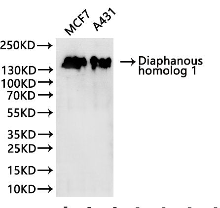 Western Blot
Positive WB detected in: MCF7 whole cell lysate(30µg), A431 whole cell lysate(30µg)
All lanes: Diaphanous homolog 1 antibody at 1:1000
Secondary
Goat polyclonal to rabbit IgG at 1/40000 dilution
Predicted band size: 141 kDa
Observed band size: 150 kDa
Exposure time：2min