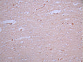 IHC image of CSB-RA080928A0HU diluted at 1:100 and staining in paraffin-embedded human brain tissue performed on a Leica BondTM system. After dewaxing and hydration, antigen retrieval was mediated by high pressure in a citrate buffer (pH 6.0). Section was blocked with 10% normal goat serum 30min at RT. Then primary antibody (1% BSA) was incubated at 4°C overnight. The primary is detected by a Goat anti-rabbit polymer IgG labeled by HRP and visualized using 0.05% DAB.