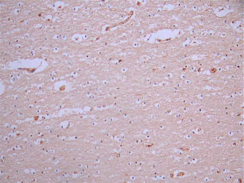 IHC image of CSB-RA080928A0HU diluted at 1:100 and staining in paraffin-embedded human brain tissue performed on a Leica BondTM system. After dewaxing and hydration, antigen retrieval was mediated by high pressure in a citrate buffer (pH 6.0). Section was blocked with 10% normal goat serum 30min at RT. Then primary antibody (1% BSA) was incubated at 4°C overnight. The primary is detected by a Goat anti-rabbit polymer IgG labeled by HRP and visualized using 0.05% DAB.