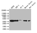 Western Blot
Positive WB detected in: K562 whole cell lysate, THP-1 whole cell lysate, Mouse brain tissue lysate, Rat brain tissue lysate,
All lanes: CREB antibody at 1:1000
Secondary
Goat polyclonal to rabbit IgG at 1/50000 dilution
Predicted band size: 36 kDa
Observed band size: 36 kDa