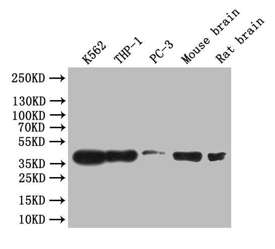 Western Blot
Positive WB detected in: K562 whole cell lysate, THP-1 whole cell lysate, Mouse brain tissue lysate, Rat brain tissue lysate,
All lanes: CREB antibody at 1:1000
Secondary
Goat polyclonal to rabbit IgG at 1/50000 dilution
Predicted band size: 36 kDa
Observed band size: 36 kDa