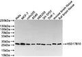 Western Blot
Positive WB detected in: HeLa whole cell lysate(30µg) , MCF-7 whole cell lysate(30µg) , colo205 whole cell lysate(30µg) , A549 whole cell lysate(30µg) , HEK293 whole cell lysate(30µg) , SH-SY5Y whole cell lysate(30µg) , THP-1 whole cell lysate(30µg) , Mouse brain tissue lysate(30µg) , Rat brain tissue lysate(30µg) 
All lanes: HSD17B10 antibody at 1:1000
Secondary
Goat polyclonal to rabbit IgG at 1/40000 dilution
Predicted band size: 27 kDa
Observed band size: 27 kDa
Exposure time：1min