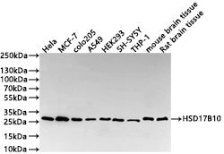 Western Blot
Positive WB detected in: HeLa whole cell lysate(30µg) , MCF-7 whole cell lysate(30µg) , colo205 whole cell lysate(30µg) , A549 whole cell lysate(30µg) , HEK293 whole cell lysate(30µg) , SH-SY5Y whole cell lysate(30µg) , THP-1 whole cell lysate(30µg) , Mouse brain tissue lysate(30µg) , Rat brain tissue lysate(30µg) 
All lanes: HSD17B10 antibody at 1:1000
Secondary
Goat polyclonal to rabbit IgG at 1/40000 dilution
Predicted band size: 27 kDa
Observed band size: 27 kDa
Exposure time：1min