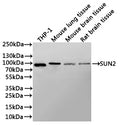 Western Blot
Positive WB detected in: THP-1 whole cell lysate(30µg), Mouse lung tissue lysate(30µg), Mouse brain tissue lysate(30µg), Rat brain tissue lysate(30µg)
All lanes: SUN2 antibody at 1:1000
Secondary
Goat polyclonal to rabbit IgG at 1/40000 dilution
Predicted band size: 80 kDa
Observed band size: 80 kDa
Exposure time：3min