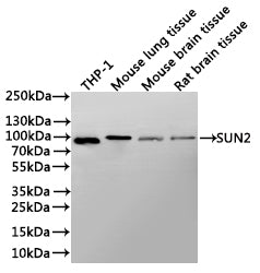 Western Blot
Positive WB detected in: THP-1 whole cell lysate(30µg), Mouse lung tissue lysate(30µg), Mouse brain tissue lysate(30µg), Rat brain tissue lysate(30µg)
All lanes: SUN2 antibody at 1:1000
Secondary
Goat polyclonal to rabbit IgG at 1/40000 dilution
Predicted band size: 80 kDa
Observed band size: 80 kDa
Exposure time：3min