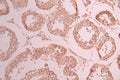 IHC image of CSB-RA084523A0HU diluted at 1:100 and staining in paraffin-embedded human testis tissue performed on a Leica BondTM system. After dewaxing and hydration, antigen retrieval was mediated by high pressure in a citrate buffer (pH 6.0) . Section was blocked with 10% normal goat serum 30min at RT. Then primary antibody (1% BSA) was incubated at 4°C overnight. The primary is detected by a Goat anti-rabbit polymer IgG labeled by HRP and visualized using 0.05% DAB.