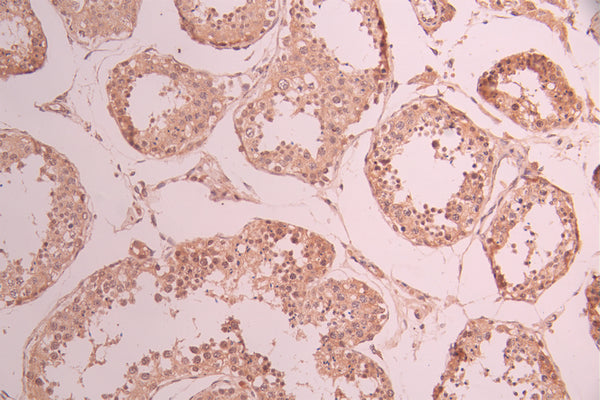 IHC image of CSB-RA084523A0HU diluted at 1:100 and staining in paraffin-embedded human testis tissue performed on a Leica BondTM system. After dewaxing and hydration, antigen retrieval was mediated by high pressure in a citrate buffer (pH 6.0) . Section was blocked with 10% normal goat serum 30min at RT. Then primary antibody (1% BSA) was incubated at 4°C overnight. The primary is detected by a Goat anti-rabbit polymer IgG labeled by HRP and visualized using 0.05% DAB.