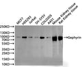 Western Blot
Positive WB detected in: MCF7 whole cell lysate(30µg), HEK293 whole cell lysate(30µg), Jurkat whole cell lysate(30µg), SH-SY5Y whole cell lysate(30µg), COLO205 whole cell lysate(30µg), A431 whole cell lysate(30µg), Mouse kidney tissue lysate(30µg), Rat kidney tissue lysate(30µg)
All lanes: Gephyrin antibody at 1:1000
Secondary
Goat polyclonal to rabbit IgG at 1/40000 dilution
Predicted band size: 80 kDa
Observed band size: 93 kDa
Exposure time：2min