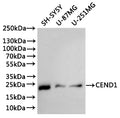 Western Blot
Positive WB detected in: SHS-SY5Y whole cell lysate(30µg), U-87MG whole cell lysate(30µg), U-251MG whole cell lysate(30µg)
All lanes: CEND1 antibody at 1:1000
Secondary
Goat polyclonal to rabbit IgG at 1/40000 dilution
Predicted band size: 15 kDa
Observed band size: 22 kDa
Exposure time：2min