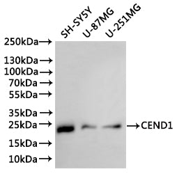 Western Blot
Positive WB detected in: SHS-SY5Y whole cell lysate(30µg), U-87MG whole cell lysate(30µg), U-251MG whole cell lysate(30µg)
All lanes: CEND1 antibody at 1:1000
Secondary
Goat polyclonal to rabbit IgG at 1/40000 dilution
Predicted band size: 15 kDa
Observed band size: 22 kDa
Exposure time：2min