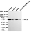 Western Blot
Positive WB detected in: HL-60 whole cell lysate(30µg) , MCF-7 whole cell lysate(30µg) , Hela whole cell lysate(30µg) , Mouse brain tissue lysate(30µg) 
All lanes: PHD1 antibody at 1:1000
Secondary
Goat polyclonal to rabbit IgG at 1/40000 dilution
Predicted band size: 44 kDa
Observed band size: 55 kDa
Exposure time：2min