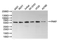 Western Blot
Positive WB detected in: A431 whole cell lysate(30µg), MCF-7 whole cell lysate(30µg), Jurkat whole cell lysate(30µg), SH-SY5Y whole cell lysate(30µg), HT-29 whole cell lysate(30µg), A2780 whole cell lysate(30µg)
All lanes: PNKP antibody at 1:1000
Secondary
Goat polyclonal to rabbit IgG at 1/40000 dilution
Predicted band size: 57 kDa
Observed band size: 57 kDa
Exposure time：3min