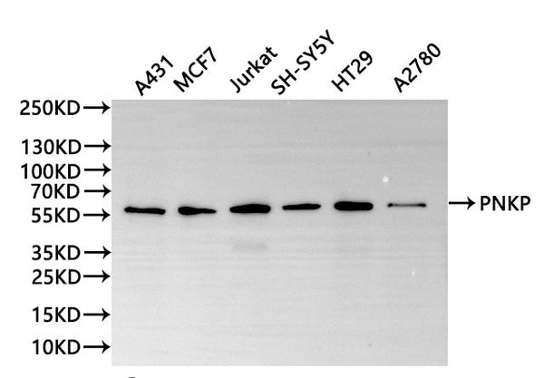 Western Blot
Positive WB detected in: A431 whole cell lysate(30µg), MCF-7 whole cell lysate(30µg), Jurkat whole cell lysate(30µg), SH-SY5Y whole cell lysate(30µg), HT-29 whole cell lysate(30µg), A2780 whole cell lysate(30µg)
All lanes: PNKP antibody at 1:1000
Secondary
Goat polyclonal to rabbit IgG at 1/40000 dilution
Predicted band size: 57 kDa
Observed band size: 57 kDa
Exposure time：3min