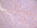 IHC image of CSB-RA090368A0HU diluted at 1:100 and staining in paraffin-embedded human tonsil tissue performed on a Leica BondTM system. After dewaxing and hydration, antigen retrieval was mediated by high pressure in a citrate buffer (pH 6.0). Section was blocked with 10% normal goat serum 30min at RT. Then primary antibody (1% BSA) was incubated at 4°C overnight. The primary is detected by a Goat anti-rabbit polymer IgG labeled by HRP and visualized using 0.05% DAB.