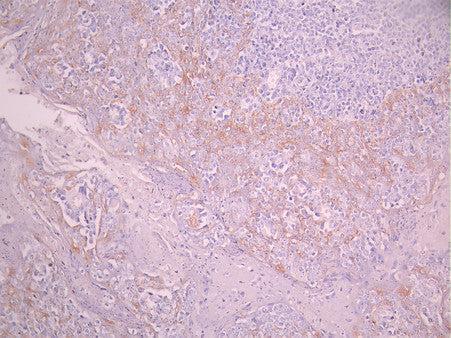 IHC image of CSB-RA090368A0HU diluted at 1:100 and staining in paraffin-embedded human tonsil tissue performed on a Leica BondTM system. After dewaxing and hydration, antigen retrieval was mediated by high pressure in a citrate buffer (pH 6.0). Section was blocked with 10% normal goat serum 30min at RT. Then primary antibody (1% BSA) was incubated at 4°C overnight. The primary is detected by a Goat anti-rabbit polymer IgG labeled by HRP and visualized using 0.05% DAB.