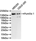 Western Blot
Positive WB detected in: HEK293 whole cell lysate(30µg) ,COLO-205 whole cell lysate(30µg) 
All lanes: Pumilio 1 antibody at 1:1000
Secondary
Goat polyclonal to rabbit IgG at 1/40000 dilution
Predicted band size: 126 kDa
Observed band size: 140 kDa
Exposure time：2min