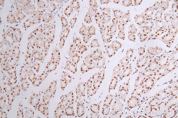 IHC image of CSB-RA090878A0HU diluted at 1:50 and staining in paraffin-embedded human stomach tissue performed on a Leica BondTM system. After dewaxing and hydration, antigen retrieval was mediated by high pressure in a citrate buffer (pH 6.0) . Section was blocked with 10% normal goat serum 30min at RT. Then primary antibody (1% BSA) was incubated at 4°C overnight. The primary is detected by a Goat anti-rabbit polymer IgG labeled by HRP and visualized using 0.44% DAB.