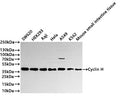 Western Blot
Positive WB detected in: SW620 whole cell lysate(30µg) ,HEK293 whole cell lysate(30µg) , Raji whole cell lysate(30µg) , Hela whole cell lysate(30µg) ,A549 whole cell lysate(30µg) ,K562 whole cell lysate(30µg) ,Mouse small intestine tissue lysate(30µg) 
All lanes: Cyclin H antibody at 1:1000
Secondary
Goat polyclonal to rabbit IgG at 1/40000 dilution
Predicted band size: 38 kDa
Observed band size: 38 kDa
Exposure time：2min