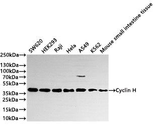 Western Blot
Positive WB detected in: SW620 whole cell lysate(30µg) ,HEK293 whole cell lysate(30µg) , Raji whole cell lysate(30µg) , Hela whole cell lysate(30µg) ,A549 whole cell lysate(30µg) ,K562 whole cell lysate(30µg) ,Mouse small intestine tissue lysate(30µg) 
All lanes: Cyclin H antibody at 1:1000
Secondary
Goat polyclonal to rabbit IgG at 1/40000 dilution
Predicted band size: 38 kDa
Observed band size: 38 kDa
Exposure time：2min