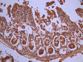 IHC image of CSB-RA091918A0HU diluted at 1:100 and staining in paraffin-embedded human small intestine tissue performed on a Leica BondTM system. After dewaxing and hydration, antigen retrieval was mediated by high pressure in a citrate buffer (pH 6.0). Section was blocked with 10% normal goat serum 30min at RT. Then primary antibody (1% BSA) was incubated at 4°C overnight. The primary is detected by a Goat anti-rabbit polymer IgG labeled by HRP and visualized using 0.05% DAB.