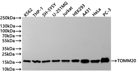 Western Blot
Positive WB detected in: K562 whole cell lysate(30µg) , THP-1 whole cell lysate(30µg) , SH-SY5Y whole cell lysate(30µg) , U-251MG whole cell lysate(30µg) , Jurkat whole cell lysate(30µg) , HEK293 whole cell lysate(30µg) , A431 whole cell lysate(30µg) , HeLa whole cell lysate(30µg) , PC-3 whole cell lysate(30µg) 
All lanes: TOMM20 antibody at 1:1000
Secondary
Goat polyclonal to rabbit IgG at 1/40000 dilution
Predicted band size: 16 kDa
Observed band size: 16 kDa
Exposure time：1min