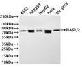 Western Blot
Positive WB detected in: K562 whole cell lysate(30µg) , HEK293 whole cell lysate(30µg) , HepG2 whole cell lysate(30µg) , Hela whole cell lysate(30µg) , SH-SY5Y whole cell lysate(30µg) 
All lanes: PIAS1/2 antibody at 1:1000
Secondary
Goat polyclonal to rabbit IgG at 1/40000 dilution
Predicted band size: 76 kDa
Observed band size: 76 kDa
Exposure time：1min