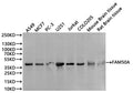 Western Blot
Positive WB detected in: A549 whole cell lysate(30µg), MCF-7 whole cell lysate(30µg), PC-3 whole cell lysate(30µg), U-251MG whole cell lysate(30µg), Jurkat whole cell lysate(30µg), COLO-205 whole cell lysate(30µg), Mouse brain tissue lysate(30µg), Rat brain tissue lysate(30µg)
All lanes: FAM50A antibody at 1:1000
Secondary
Goat polyclonal to rabbit IgG at 1/40000 dilution
Predicted band size: 40 kDa
Observed band size: 40 kDa
Exposure time：1min