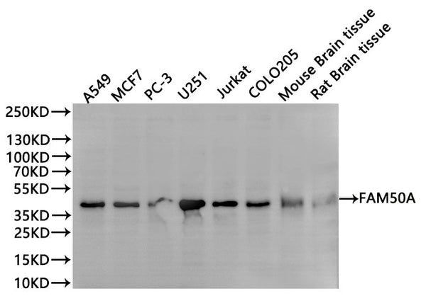 Western Blot
Positive WB detected in: A549 whole cell lysate(30µg), MCF-7 whole cell lysate(30µg), PC-3 whole cell lysate(30µg), U-251MG whole cell lysate(30µg), Jurkat whole cell lysate(30µg), COLO-205 whole cell lysate(30µg), Mouse brain tissue lysate(30µg), Rat brain tissue lysate(30µg)
All lanes: FAM50A antibody at 1:1000
Secondary
Goat polyclonal to rabbit IgG at 1/40000 dilution
Predicted band size: 40 kDa
Observed band size: 40 kDa
Exposure time：1min