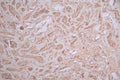IHC image of CSB-RA095825A0HU diluted at 1:100 and staining in paraffin-embedded human kidney tissue performed on a Leica BondTM system. After dewaxing and hydration, antigen retrieval was mediated by high pressure in a citrate buffer (pH 6.0) . Section was blocked with 10% normal goat serum 30min at RT. Then primary antibody (1% BSA) was incubated at 4°C overnight. The primary is detected by a Goat anti-rabbit polymer IgG labeled by HRP and visualized using 0.56% DAB.