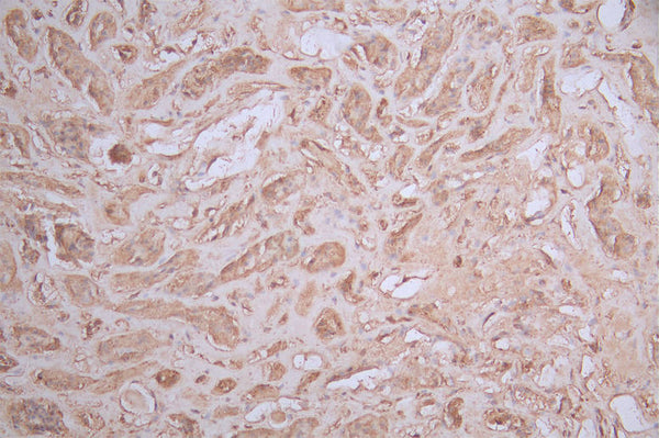 IHC image of CSB-RA095825A0HU diluted at 1:100 and staining in paraffin-embedded human kidney tissue performed on a Leica BondTM system. After dewaxing and hydration, antigen retrieval was mediated by high pressure in a citrate buffer (pH 6.0) . Section was blocked with 10% normal goat serum 30min at RT. Then primary antibody (1% BSA) was incubated at 4°C overnight. The primary is detected by a Goat anti-rabbit polymer IgG labeled by HRP and visualized using 0.56% DAB.