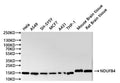 Western Blot
Positive WB detected in: Hela whole cell lysate(30µg), A549 whole cell lysate(30µg), SH-SY5Y whole cell lysate(30µg), MCF-7 whole cell lysate(30µg), A431 whole cell lysate(30µg), THP-1 whole cell lysate(30µg), Mouse brain tissue lysate(30µg), Rat brain tissue lysate(30µg)
All lanes: NDUFB4 antibody at 1:1000
Secondary
Goat polyclonal to rabbit IgG at 1/40000 dilution
Predicted band size: 15 kDa
Observed band size: 15 kDa
Exposure time：1min