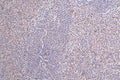 IHC image of CSB-RA097934A0HU diluted at 1:100 and staining in paraffin-embedded human spleen tissue performed on a Leica BondTM system. After dewaxing and hydration, antigen retrieval was mediated by high pressure in a citrate buffer (pH 6.0) . Section was blocked with 10% normal goat serum 30min at RT. Then primary antibody (1% BSA) was incubated at 4°C overnight. The primary is detected by a Goat anti-rabbit polymer IgG labeled by HRP and visualized using 0.25% DAB.