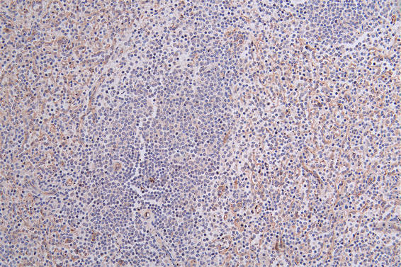 IHC image of CSB-RA097934A0HU diluted at 1:100 and staining in paraffin-embedded human spleen tissue performed on a Leica BondTM system. After dewaxing and hydration, antigen retrieval was mediated by high pressure in a citrate buffer (pH 6.0) . Section was blocked with 10% normal goat serum 30min at RT. Then primary antibody (1% BSA) was incubated at 4°C overnight. The primary is detected by a Goat anti-rabbit polymer IgG labeled by HRP and visualized using 0.25% DAB.