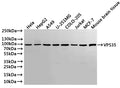 Western Blot
Positive WB detected in: Hela whole cell lysate(30µg), HepG2 whole cell lysate(30µg), A549 whole cell lysate(30µg), U-251MG whole cell lysate(30µg), COLO-205 whole cell lysate(30µg), Jurkat whole cell lysate(30µg), MCF-7 whole cell lysate(30µg), Mouse brain tissue lysate(30µg)
All lanes: VPS35 antibody at 1:1000
Secondary
Goat polyclonal to rabbit IgG at 1/40000 dilution
Predicted band size: 92 kDa
Observed band size: 92 kDa
Exposure time：1min