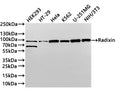 Western Blot
Positive WB detected in: HEK293 whole cell lysate(30µg) ,HT-29 whole cell lysate(30µg) ,Hela whole cell lysate(30µg) ,k562 whole cell lysate(30µg) ,U-251MG whole cell lysate(30µg) ,NIH/3T3 whole cell lysate(30µg) 
All lanes: Radixin antibody at 1:1000
Secondary
Goat polyclonal to rabbit IgG at 1/40000 dilution
Predicted band size: 69 kDa
Observed band size: 69,80 kDa
Exposure time：2min