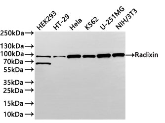 Western Blot
Positive WB detected in: HEK293 whole cell lysate(30µg) ,HT-29 whole cell lysate(30µg) ,Hela whole cell lysate(30µg) ,k562 whole cell lysate(30µg) ,U-251MG whole cell lysate(30µg) ,NIH/3T3 whole cell lysate(30µg) 
All lanes: Radixin antibody at 1:1000
Secondary
Goat polyclonal to rabbit IgG at 1/40000 dilution
Predicted band size: 69 kDa
Observed band size: 69,80 kDa
Exposure time：2min