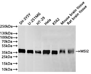 Western Blot
Positive WB detected in: SH-SY5Y whole cell lysate(30µg) , U-251MG whole cell lysate(30µg) , HT-29 whole cell lysate(30µg) , Hela whole cell lysate(30µg) , K562 whole cell lysate(30µg) , Mouse brain tissue lysate(30µg) , Rat brain tissue lysate(30µg) 
All lanes: MSI2 antibody at 1:1000
Secondary
Goat polyclonal to rabbit IgG at 1/40000 dilution
Predicted band size: 35 kDa
Observed band size: 36 kDa
Exposure time：2min40s