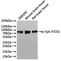 Western Blot
Positive WB detected in: HEK293 whole cell lysate(30µg), Mouse brain tissue lysate(30µg), Rat brain tissue lysate(30µg)
All lanes: p-Syk (Y323) antibody at 1:1000
Secondary
Goat polyclonal to rabbit IgG at 1/40000 dilution
Predicted band size: 72 kDa
Observed band size: 72 kDa
Exposure time：3min