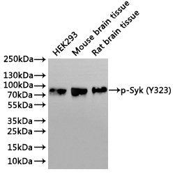 Western Blot
Positive WB detected in: HEK293 whole cell lysate(30µg), Mouse brain tissue lysate(30µg), Rat brain tissue lysate(30µg)
All lanes: p-Syk (Y323) antibody at 1:1000
Secondary
Goat polyclonal to rabbit IgG at 1/40000 dilution
Predicted band size: 72 kDa
Observed band size: 72 kDa
Exposure time：3min