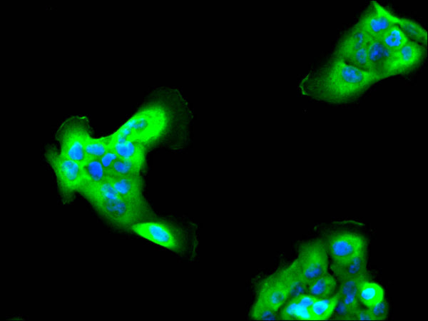 Immunofluorescence staining of A431 cell with CSB-RA100602A0HU at 1:50, counter-stained with DAPI. The cells were fixed in 4% formaldehyde, permeabilized using 0.2% Triton X-100 and blocked in 10% normal Goat Serum. The cells were then incubated with the antibody overnight at 4°C. The secondary antibody was Alexa Fluor 488-congugated AffiniPure Goat Anti-Rabbit IgG(H+L) .