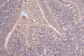 IHC image of CSB-RA101461A0HU diluted at 1:50 and staining in paraffin-embedded human lung tissue performed on a Leica BondTM system. After dewaxing and hydration, antigen retrieval was mediated by high pressure in a citrate buffer (pH 6.0) . Section was blocked with 10% normal goat serum 30min at RT. Then primary antibody (1% BSA) was incubated at 4°C overnight. The primary is detected by a Goat anti-rabbit polymer IgG labeled by HRP and visualized using 0.63% DAB.
