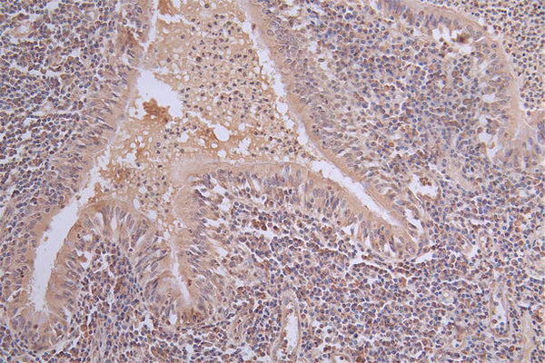 IHC image of CSB-RA101461A0HU diluted at 1:50 and staining in paraffin-embedded human lung tissue performed on a Leica BondTM system. After dewaxing and hydration, antigen retrieval was mediated by high pressure in a citrate buffer (pH 6.0) . Section was blocked with 10% normal goat serum 30min at RT. Then primary antibody (1% BSA) was incubated at 4°C overnight. The primary is detected by a Goat anti-rabbit polymer IgG labeled by HRP and visualized using 0.63% DAB.